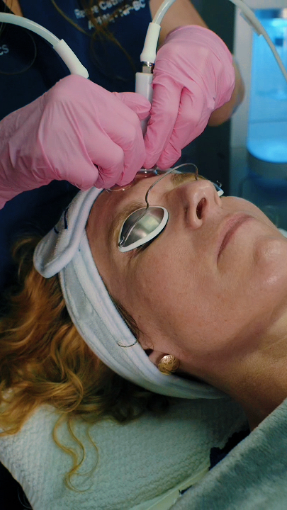 Hydrodermabrasion Facial